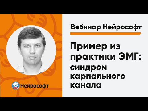 Видео: Пример из практики ЭМГ: синдром карпального канала | Вебинар Нейрософт