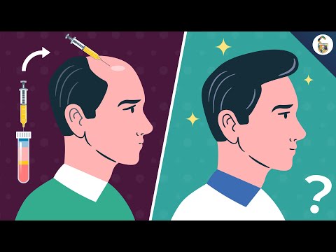 Видео: Помогает ли PRP-терапия при выпадении волос у мужчин?