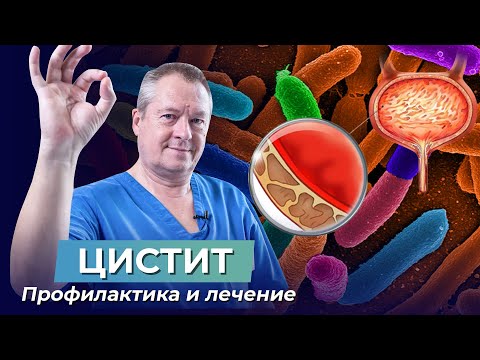 Видео: Первая помощь при ЦИСТИТЕ! 2 СОВЕТА как быстро снять приступ ЦИСТИТА в домашних условиях?