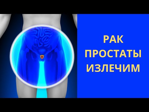 Видео: Инновационная медицина | Онкология простаты | Метастазы в костях