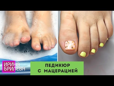 Видео: ПЕДИКЮР с мацерацией 🌸 Педикюр пилкой 🌸 Ирина Брилёва
