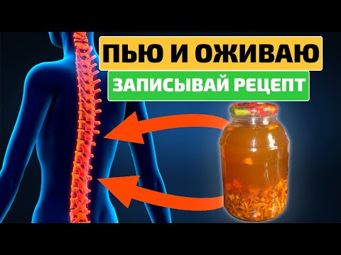 Видео: Вылечила остеохондроз и грыжу позвоночника! Помогла эта настойка из сабельника