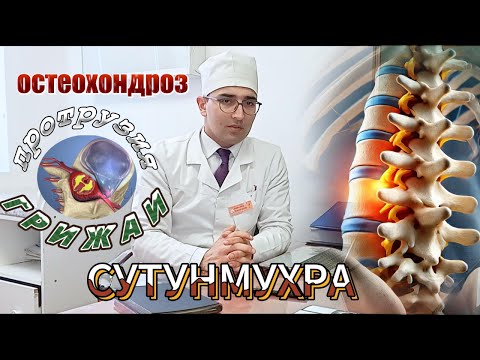 Видео: Бемориҳои сутунмухра – Остеохондроз, Протрузия, Грижа | Дарди миён ва гардан!  Сабабхо ва Табобат