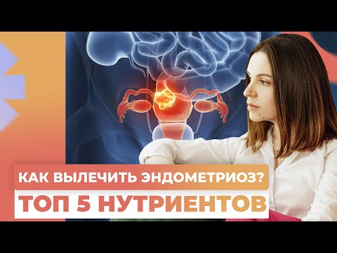 Видео: ВЫЛЕЧИТЕ ЭНДОМЕТРИОЗ самостоятельно ! ТОП 5 добавок, которые УМЕНЬШАТ БОЛЬ при эндометриозе!