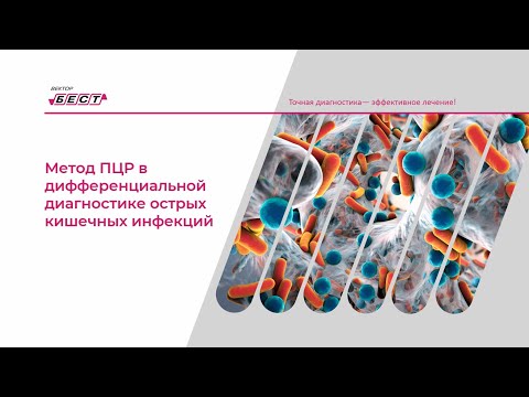 Видео: Метод ПЦР в дифференциальной диагностике ОКИ