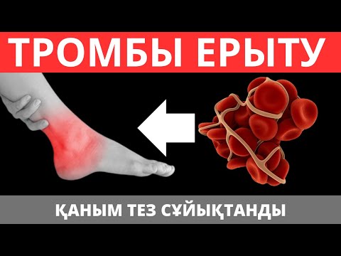 Видео: Қантамырдағы Ұйыған ҚАНДЫ тез ерітетін ТОП 5 тағам. Қан тамыр аурулары