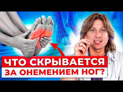 Видео: ОНЕМЕНИЕ НОГ=САХАРНЫЙ ДИАБЕТ!? / Почему немеют ноги и какие СТРАШНЫЕ последствия могут быть?