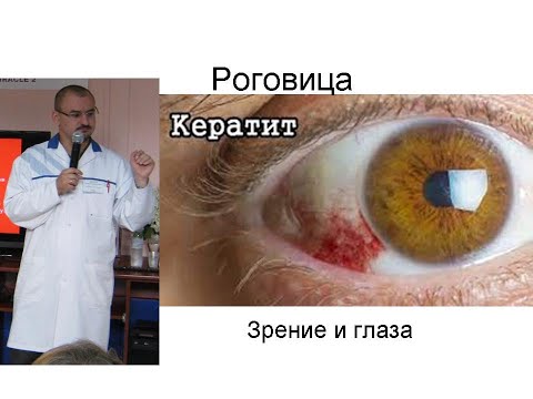 Видео: Роговица и кератит. Кератоконус.