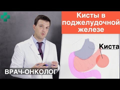 Видео: Кисты в поджелудочной железе. Причины, симптомы и диагностика