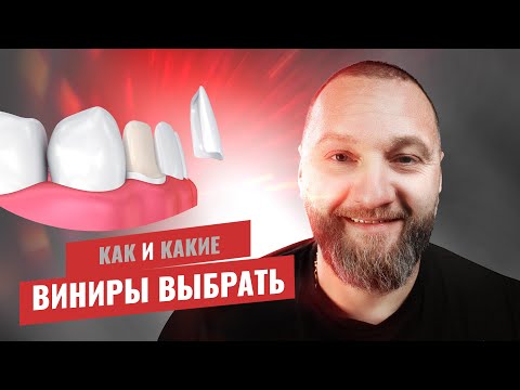 Видео: 🇺🇦 Виниры - плюсы и минусы, как, и какие выбрать