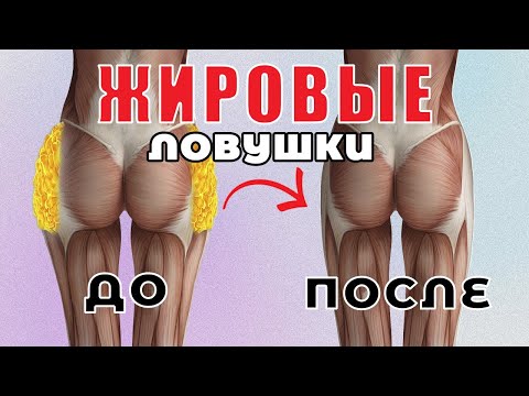 Видео: УБИРАЕМ УШКИ НА БЕДРАХ. Эффективные упражнения от ГАЛИФЕ и ПОПИНЫХ УШЕЙ