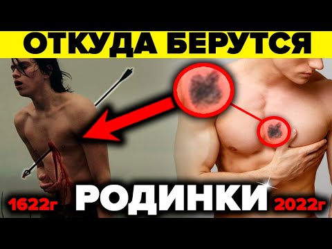 Видео: Врачи боятся даже думать об этом! Как Родинки связаны с прошлыми жизнями и причём тут психосоматика?