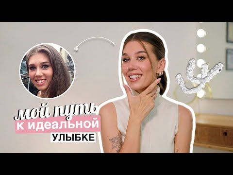 Видео: ПУТЬ К ИДЕАЛЬНОЙ УЛЫБКE, МОЯ ИСТОРИЯ, БРЕКЕТЫ ИЛИ ЭЛАЙНЕРЫ | MrsWikie5