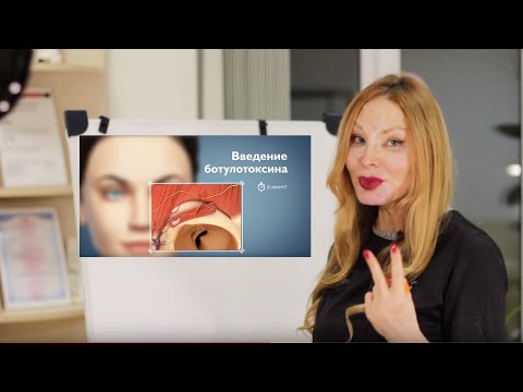 Видео: БОТОКС ПРАВИЛЬНО. Ботулинотерапия в косметологии. Передача "Белая Доска"