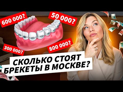 Видео: СКОЛЬКО СТОЯТ БРЕКЕТЫ С МОСКВЕ