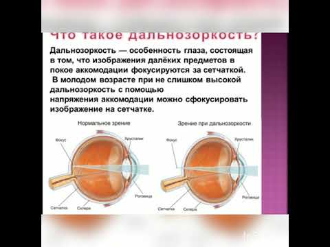 Видео: 8 класс. Глаз как оптическая система, дефекты зрения и способы их исправления