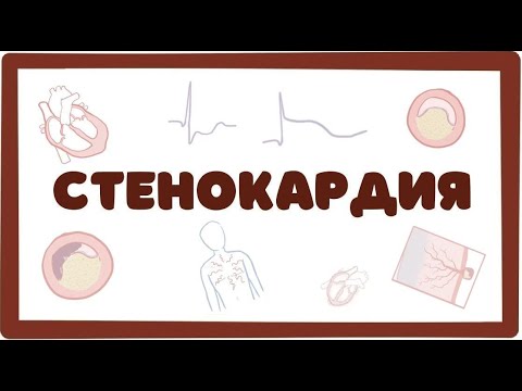 Видео: Стенокардия - причины, симптомы (лекция) Osmosis