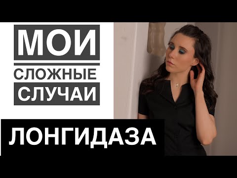 Видео: ГИАЛУРОНИДАЗА. ВСЯ ПРАВДА/УБРАТЬ ФИЛЛЕР.