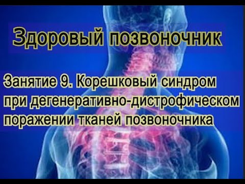 Видео: Занятие 9.   Корешковый синдром в больном позвоночнике при ДДИ.