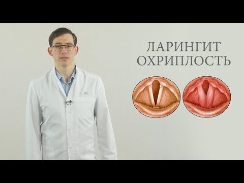 Видео: ларингит, охриплость