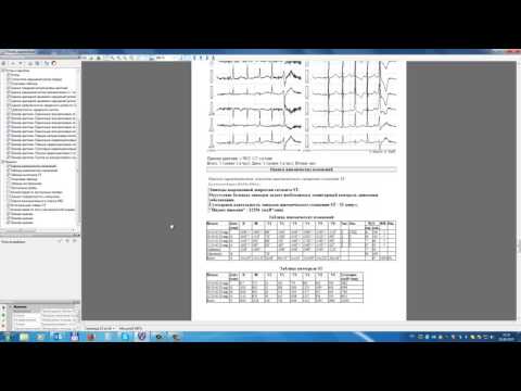 Видео: Result2/3. Страница «Оценка ишемических изменений», разбор изменений ST-T.