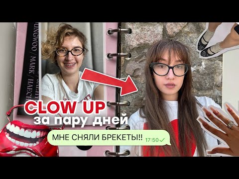 Видео: GLOW UP за пару дней! СНЯЛИ БРЕКЕТЫ, новый цвет волос и НОВЫЕ ОБРАЗЫ