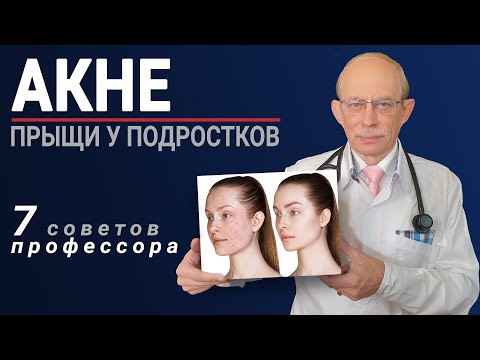 Видео: Акне прыщи на лице - лечение, причины. 7 советов профессора Няньковского как избавиться от угрей