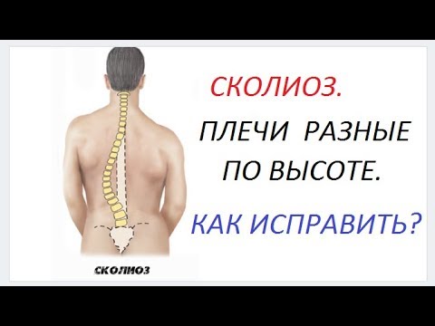 Видео: ❀ РАЗНЫЕ ПЛЕЧИ ПО ВЫСОТЕ. КАК ЗРИТЕЛЬНО ИСПРАВИТЬ ПРОБЛЕМУ.❀𝔻𝕚𝕟𝕒  𝕂𝕣𝕒𝕧𝕔𝕙𝕖𝕟𝕜𝕠. ❀