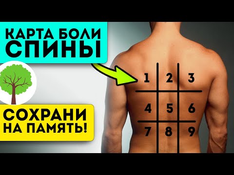 Видео: Вот как БЫСТРО УЗНАТЬ, почему у Вас БОЛИТ СПИНА! Карта боли спины, боль в пояснице, позвоночнике