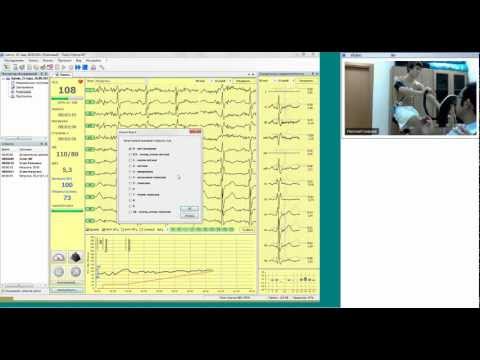 Видео: Основы ЭКГ (вебинар), ч.2