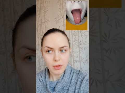 Видео: Лечение скарлатины без антибиотиков, отзыв мамы