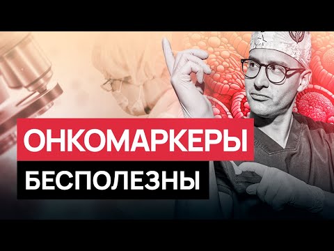 Видео: Самый бесполезный анализ на рак! Тест на онкомаркеры - дорого и неэффективно! #онкология #рак #рмж