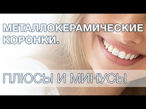 Видео: Металлокерамические коронки плюсы и минусы.