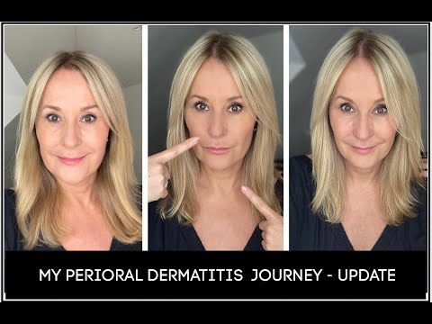 Видео: ОБНОВЛЕНИЕ ПО ПЕРИОРАЛЬНОМУ ДЕРМАТИТУ