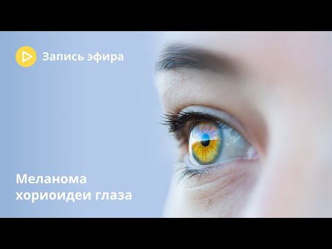 Видео: Меланома глаза