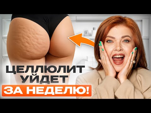 Видео: ВОТ ПОЧЕМУ у вас целлюлит! / Почему появляется целлюлит и как от него ИЗБАВИТЬСЯ?