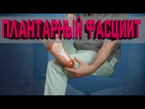 Видео: Плантарный фасциит.  Что это такое? Как вылечить?