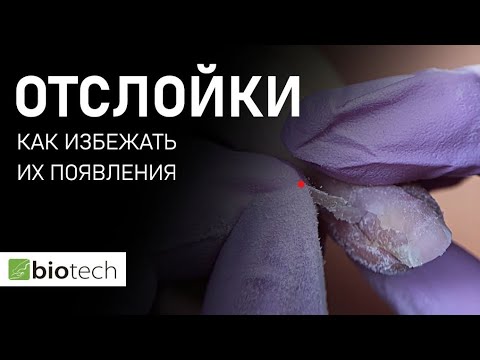 Видео: ОТСЛОЙКИ🤦🏽‍♀️ЧТО ДЕЛАТЬ, ЧТОБЫ ИХ НЕ БЫЛО!