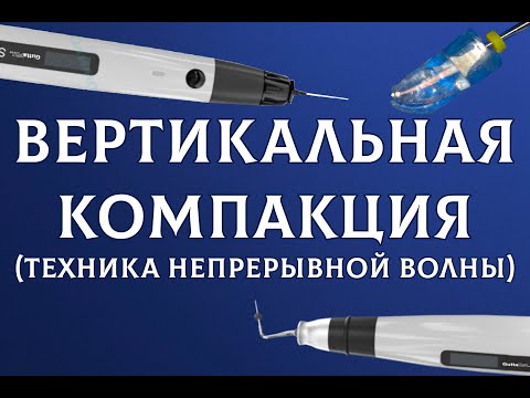 Видео: Вертикальная компакция методика непрерывной волны. Пломбировка жидкой гуттаперчей GuttaFill Guttaest