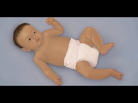 Видео: Бронхиолит (автор: А. Гроудон) | OPENPediatrics