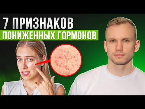 Видео: ГЛАВНЫЕ признаки того, что у вас ПОНИЖЕННЫЕ гормоны!