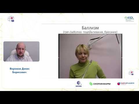 Видео: Постинсультные двигательные нарушения. Воронов Д.Б.