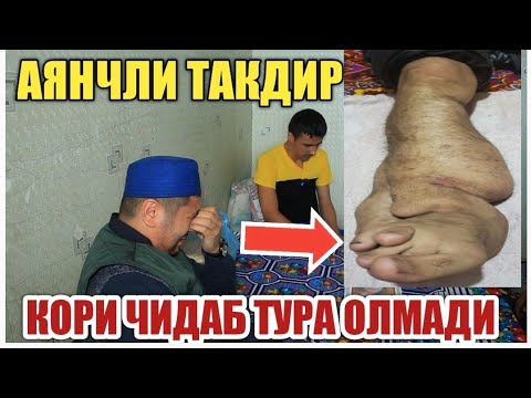 Видео: АЯНЧЛИ ТАКДИР / КОРИ АКА ЧИДАБ ТУРА ОЛМАДИ ОХУНОВ ТВ  ХАЙРАТДА..