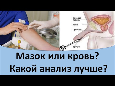 Видео: Мазок или кровь?  Какой анализ лучше?