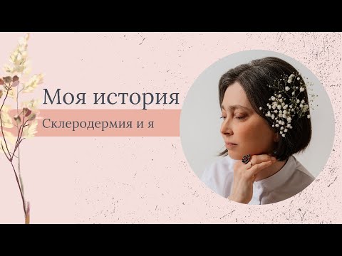 Видео: Моя история: склеродермия и я