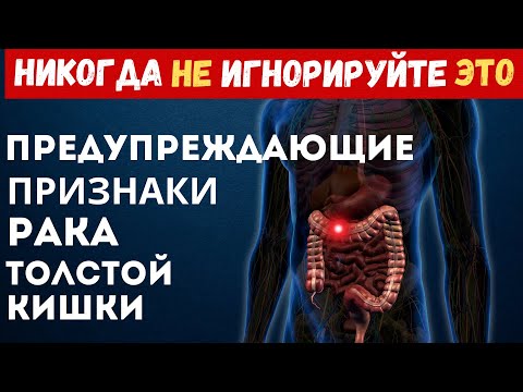 Видео: Предупреждающие Признаки Рака Толстой Кишки, Которые Никогда не Следует Игнорировать!