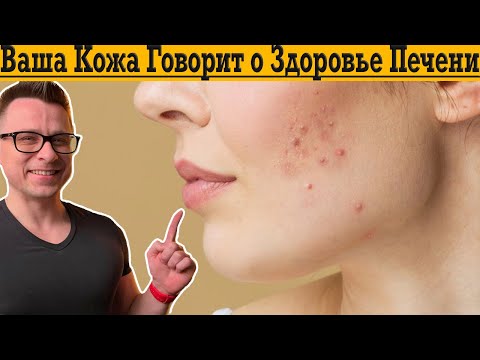 Видео: 10 СПОСОБОВ БЫСТРО ОЧИСТИТЬ КОЖУ!
