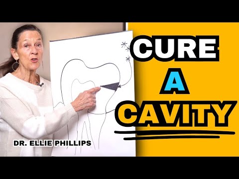 Видео: Устраните кариес с помощью этой простой системы и забудьте о пломбировании навсегда