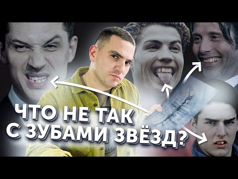 Видео: Проблемы с зубами у звезд: Криштиану Роналду, Том Харди, Мадс Миккельсен, Том Круз