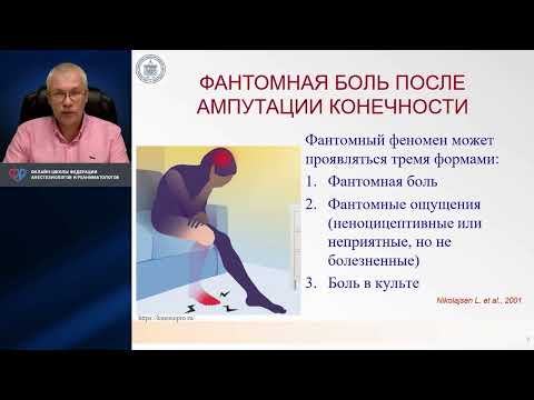 Видео: Фантомный синдром Карелов А.Е.